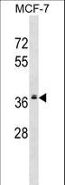 MRPL2 Antibody - MRPL2 Antibody western blot of MCF-7 cell line lysates (35 ug/lane). The MRPL2 antibody detected the MRPL2 protein (arrow).