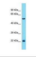 MRPL2 Antibody - Western blot of Jurkat. MRPS5 antibody dilution 1.0 ug/ml.  This image was taken for the unconjugated form of this product. Other forms have not been tested.