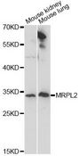 MRPL2 Antibody - Western blot analysis of extracts of various cell lines, using MRPL2 antibody at 1:1000 dilution. The secondary antibody used was an HRP Goat Anti-Rabbit IgG (H+L) at 1:10000 dilution. Lysates were loaded 25ug per lane and 3% nonfat dry milk in TBST was used for blocking. An ECL Kit was used for detection and the exposure time was 90s.