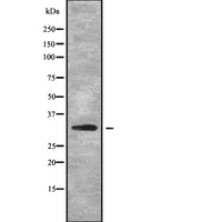 MRPL2 Antibody - Western blot analysis of MRPL2 using HuvEc whole cells lysates