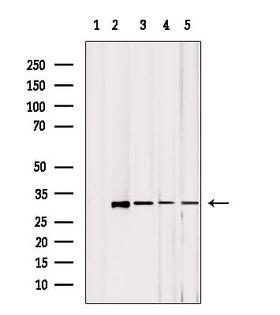 MRPL2 Antibody - Western blot analysis of extracts of various samples using MRPL2 antibody. Lane 1: mouse Myeloma cells treated with blocking peptide. Lane 2: mouse Myeloma cells; Lane 3: HeLa; Lane 4: 293; Lane 5: huvel;