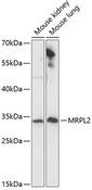 MRPL2 Antibody - Western blot analysis of extracts of various cell lines using MRPL2 Polyclonal Antibody at dilution of 1:1000.