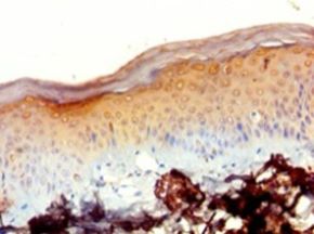 MRPL20 Antibody - Immunohistochemistry of paraffin-embedded human skin using antibody at 1:100 dilution.  This image was taken for the unconjugated form of this product. Other forms have not been tested.