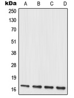 MRPL20 Antibody - Western blot analysis of MRPL20 expression in HUVEC (A); C6 (B); NIH3T3 (C); PC12 (D) whole cell lysates.