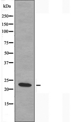 MRPL20 Antibody - Western blot analysis of extracts of COLO cells using MRPL20 antibody.