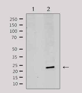 MRPL20 Antibody - Western blot analysis of extracts of rat brain tissue using MRPL20 antibody. Lane 1 was treated with the antigen-specific peptide.