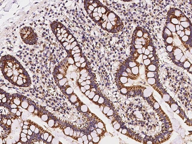 MRPL20 Antibody - Immunochemical staining of human MRPL20 in human large intestine with rabbit polyclonal antibody at 1:100 dilution, formalin-fixed paraffin embedded sections.