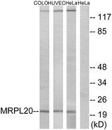 MRPL20 Antibody - Western blot analysis of extracts from COLO cells, HUVEC cells and HeLa cells, using MRPL20 antibody.