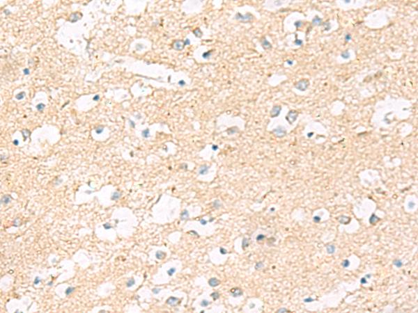 MRPL20 Antibody - Immunohistochemistry of paraffin-embedded Human brain tissue  using MRPL20 Polyclonal Antibody at dilution of 1:60(×200)