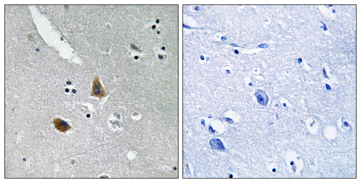 MRPL21 Antibody - Immunohistochemistry analysis of paraffin-embedded human brain tissue, using MRPL21 Antibody. The picture on the right is blocked with the synthesized peptide.