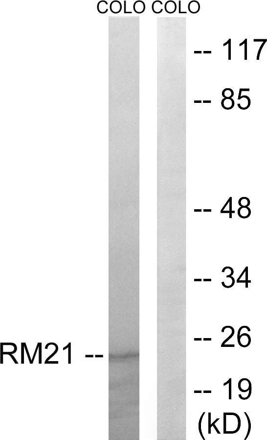 MRPL21 Antibody - Western blot analysis of lysates from COLO cells, using MRPL21 Antibody. The lane on the right is blocked with the synthesized peptide.