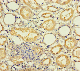 MRPL21 Antibody - Immunohistochemistry of paraffin-embedded human kidney tissue using MRPL21 Antibody at dilution of 1:100