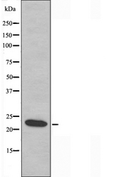 MRPL21 Antibody - Western blot analysis of extracts of COLO cells using MRPL21 antibody.