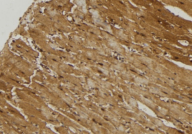 MRPL21 Antibody - 1:100 staining mouse muscle tissue by IHC-P. The sample was formaldehyde fixed and a heat mediated antigen retrieval step in citrate buffer was performed. The sample was then blocked and incubated with the antibody for 1.5 hours at 22°C. An HRP conjugated goat anti-rabbit antibody was used as the secondary.
