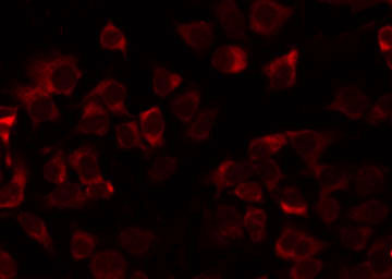 MRPL21 Antibody - Staining COLO205 cells by IF/ICC. The samples were fixed with PFA and permeabilized in 0.1% Triton X-100, then blocked in 10% serum for 45 min at 25°C. The primary antibody was diluted at 1:200 and incubated with the sample for 1 hour at 37°C. An Alexa Fluor 594 conjugated goat anti-rabbit IgG (H+L) Ab, diluted at 1/600, was used as the secondary antibody.