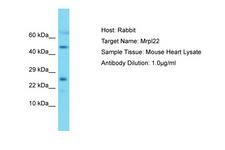 MRPL22 Antibody -  This image was taken for the unconjugated form of this product. Other forms have not been tested.