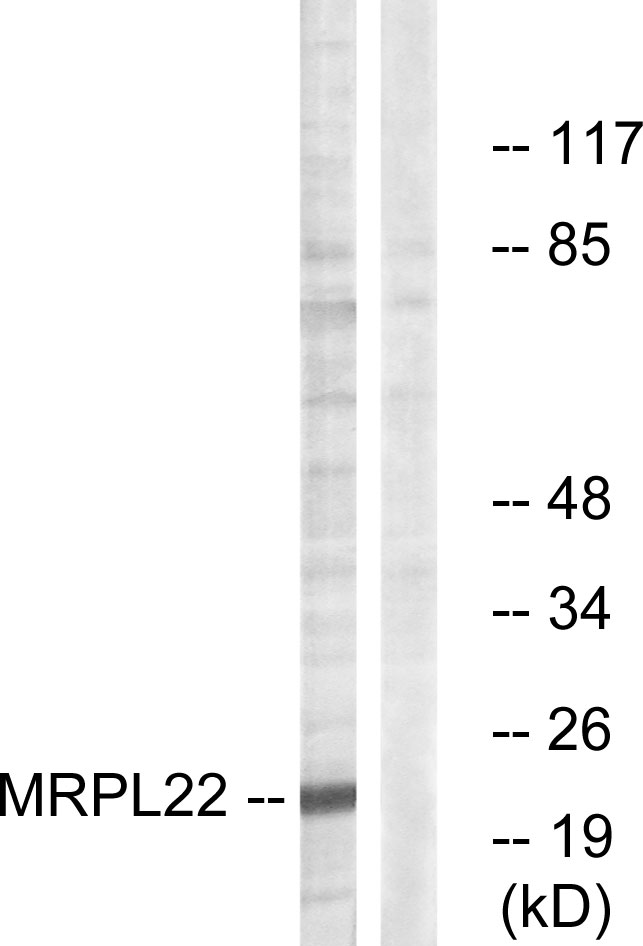 MRPL22 Antibody - Western blot analysis of lysates from HepG2 cells, using MRPL22 Antibody. The lane on the right is blocked with the synthesized peptide.