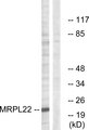 MRPL22 Antibody - Western blot analysis of lysates from HepG2 cells, using MRPL22 Antibody. The lane on the right is blocked with the synthesized peptide.