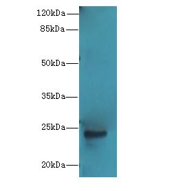 MRPL22 Antibody - Western blot. All lanes: MRPL22 antibody at 12 ug/ml+ SH-SY5Y whole cell lysate Goat polyclonal to rabbit at 1:10000 dilution. Predicted band size: 24 kDa. Observed band size: 24 kDa.