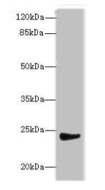 MRPL22 Antibody - Western blot All lanes: MRPL22 antibody at 12µg/ml + SH-SY5Y whole cell lysate Secondary Goat polyclonal to rabbit IgG at 1/10000 dilution Predicted band size: 24, 14, 15 kDa Observed band size: 24 kDa