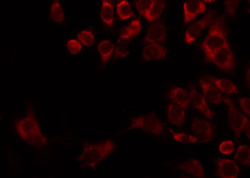 MRPL22 Antibody - Staining HepG2 cells by IF/ICC. The samples were fixed with PFA and permeabilized in 0.1% Triton X-100, then blocked in 10% serum for 45 min at 25°C. The primary antibody was diluted at 1:200 and incubated with the sample for 1 hour at 37°C. An Alexa Fluor 594 conjugated goat anti-rabbit IgG (H+L) Ab, diluted at 1/600, was used as the secondary antibody.