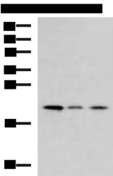 MRPL22 Antibody - Western blot analysis of Jurkat cell Mouse kidney tissue HepG2 cell lysates  using MRPL22 Polyclonal Antibody at dilution of 1:800
