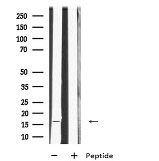 MRPL23 Antibody - Western blot analysis of MRPL23 using K562 whole cells lysates