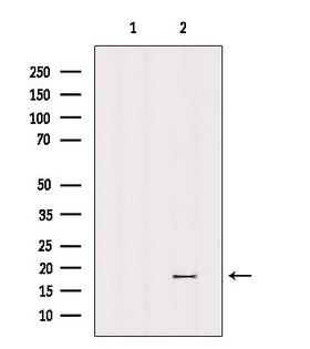 MRPL23 Antibody - Western blot analysis of extracts of c476 using MRPL23 antibody. Lane 1 was treated with the blocking peptide.