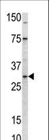 MRPL24 Antibody - Western blot of anti-MRPL24 antibody in mouse kidney tissue lysate (35 ug/lane). MRPL24 (arrow) was detected using the purified antibody.