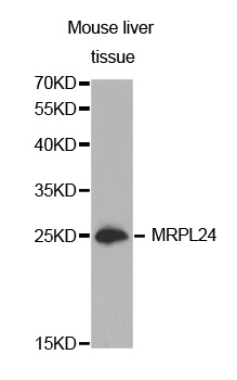 MRPL24 Antibody - Western blot analysis of extracts of Mouse liver tissue cell line, using MRPL24 antibody.