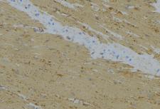 MRPL24 Antibody - 1:100 staining mouse muscle tissue by IHC-P. The sample was formaldehyde fixed and a heat mediated antigen retrieval step in citrate buffer was performed. The sample was then blocked and incubated with the antibody for 1.5 hours at 22°C. An HRP conjugated goat anti-rabbit antibody was used as the secondary.