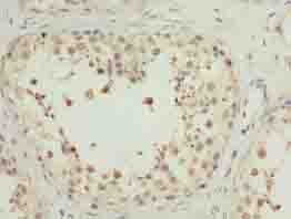 MRPL27 Antibody - Immunohistochemistry of paraffin-embedded human testis tissue using antibody at dilution of 1:100.