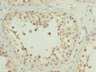MRPL27 Antibody - Immunohistochemistry of paraffin-embedded human testis tissue using MRPL27 Antibody at dilution of 1:100