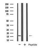MRPL27 Antibody - Western blot analysis of MRPL27 using HuvEc whole cells lysates
