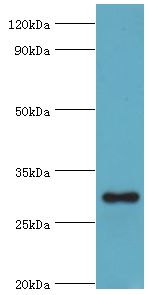 MRPL28 Antibody - Western blot. All lanes: 39S ribosomal protein L28, mitochondrial antibody at 2 ug/ml+HeLa whole cell lysate. Secondary antibody: Goat polyclonal to rabbit at 1:10000 dilution. Predicted band size: 30 kDa. Observed band size: 30 kDa Immunohistochemistry.