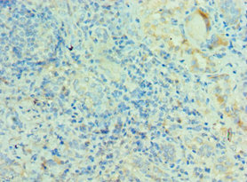 MRPL28 Antibody - Immunohistochemistry of paraffin-embedded human kidney tissue using MRPL28 Antibody at dilution of 1:100