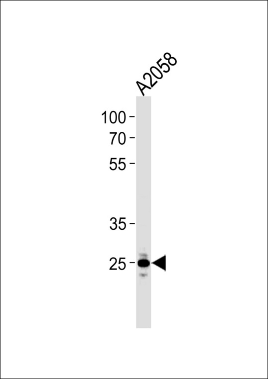 MRPL28 Antibody - MRPL28 Antibody western blot of A2058 cell line lysates (35 ug/lane). The MRPL28 antibody detected the MRPL28 protein (arrow).