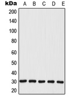 MRPL28 Antibody - Western blot analysis of MRPL28 expression in JAR (A); MCF7 (B); A549 (C); Raw264.7 (D); H9C2 (E) whole cell lysates.
