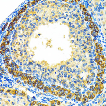 MRPL28 Antibody - Immunohistochemistry of paraffin-embedded rat ovary tissue.