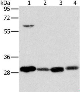 MRPL28 Antibody - Western blot analysis of 293T cell and human testis tissue, A375 cell and human normal kidney tissue, using MRPL28 Polyclonal Antibody at dilution of 1:600.
