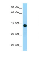 MRPL3 Antibody - MRPL3 antibody Western blot of Placenta lysate. Antibody concentration 1 ug/ml.  This image was taken for the unconjugated form of this product. Other forms have not been tested.