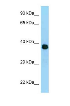 MRPL3 Antibody - MRPL3 antibody Western blot of Placenta lysate. Antibody concentration 1 ug/ml.  This image was taken for the unconjugated form of this product. Other forms have not been tested.