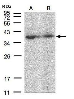 MRPL3 Antibody - Sample (30 ug of whole cell lysate). A:293T, B: A431. 12% SDS PAGE. MRPL3 antibody diluted at 1:500