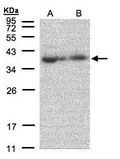 MRPL3 Antibody - Sample (30 ug of whole cell lysate). A:293T, B: A431. 12% SDS PAGE. MRPL3 antibody diluted at 1:500