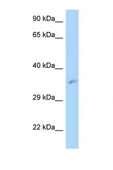 MRPL3 Antibody - MRPL3 antibody Western blot of ACHN Cell lysate. Antibody concentration 1 ug/ml.  This image was taken for the unconjugated form of this product. Other forms have not been tested.