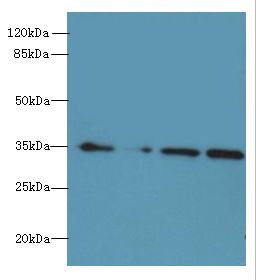 MRPL3 Antibody - Western blot. All lanes: MRPL3 antibody at 6 ug/ml. Lane 1: HeLa whole cell lysate. Lane 2: A431 whole cell lysate. Lane 3: HepG-2 whole cell lysate. Lane 4: A549 whole cell lysate. Secondary Goat polyclonal to Rabbit IgG at 1:10000 dilution. Predicted band size: 39 kDa. Observed band size: 39 kDa.