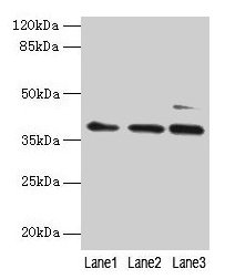 MRPL3 Antibody - Western blot All lanes: MRPL3 antibody at 6µg/ml Lane 1: Hela whole cell lysate Lane 2: A431 whole cell lysate Lane 3: HepG2 whole cell lysate Lane 4: A549 whole cell lysate Secondary Goat polyclonal to rabbit IgG at 1/10000 dilution Predicted band size: 39 kDa Observed band size: 39 kDa