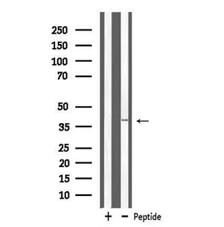 MRPL3 Antibody - Western blot analysis of extracts of K562 cells using MRPL3 antibody.