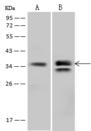 MRPL3 Antibody - Anti-MRPL3 rabbit polyclonal antibody at 1:500 dilution. Lane A: A549 Whole Cell Lysate. Lane B: ACHN Whole Cell Lysate. Lysates/proteins at 30 ug per lane. Secondary: Goat Anti-Rabbit IgG (H+L)/HRP at 1/10000 dilution. Developed using the ECL technique. Performed under reducing conditions. Predicted band size: 39 kDa. Observed band size: 39 kDa.