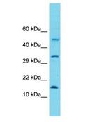MRPL30 Antibody - MRPL30 antibody Western Blot of HeLa. Antibody dilution: 1 ug/ml.  This image was taken for the unconjugated form of this product. Other forms have not been tested.